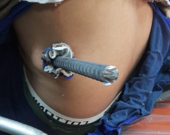 نجاح جراحة معقدة بالمستشفى العام